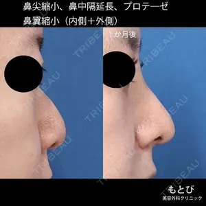 もとび美容外科クリニック 新宿院 西尾 謙三郎医師の症例