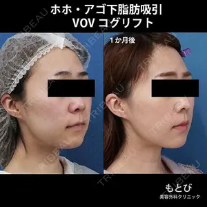 もとび美容外科クリニック 新宿院 西尾 謙三郎医師の症例