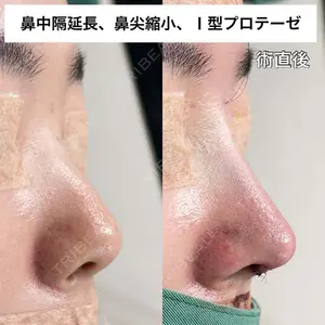 もとび美容外科クリニック 新宿院 西尾 謙三郎医師の症例