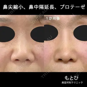 もとび美容外科クリニック 新宿院 西尾 謙三郎医師の症例