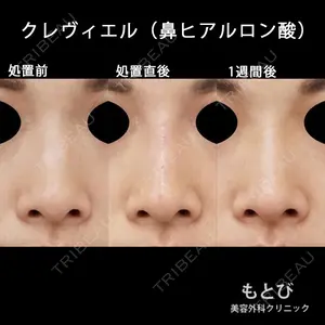 もとび美容外科クリニック 新宿院 西尾 謙三郎医師の症例