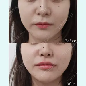 L‘amour clinic Tokyo【ラムールクリニック東京】の症例