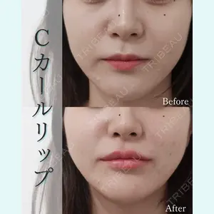 L‘amour clinic Tokyo【ラムールクリニック東京】の症例