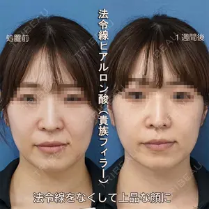 もとび美容外科クリニック 新宿院 西尾 謙三郎医師の症例