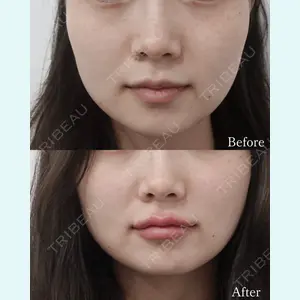 L‘amour clinic Tokyo【ラムールクリニック東京】の症例
