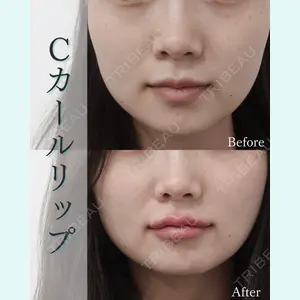 L‘amour clinic Tokyo【ラムールクリニック東京】の症例