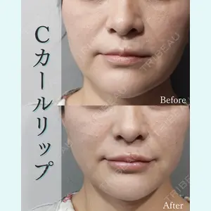 L‘amour clinic Tokyo【ラムールクリニック東京】の症例