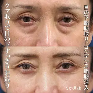 もとび美容外科クリニック 新宿院 西尾 謙三郎医師の症例