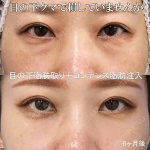 もとび美容外科クリニック 新宿院 西尾 謙三郎医師の症例