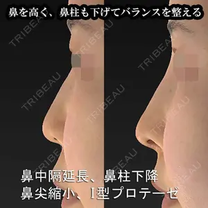 もとび美容外科クリニック 新宿院 西尾 謙三郎医師の症例