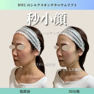 ビューティー和心クリニック 浅草院の症例