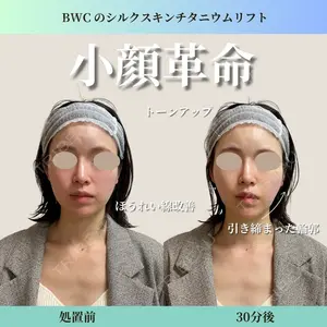 ビューティー和心クリニック 浅草院の症例