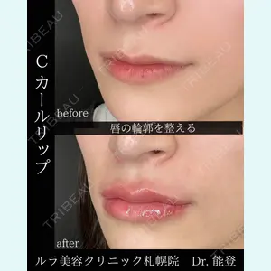 ルラ美容クリニック 札幌院 能登 貴弘医師の症例