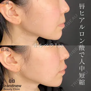 Brandnew Beauty Clinic 平山 容成医師の症例
