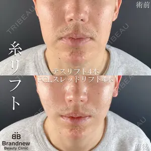 Brandnew Beauty Clinic 平山 容成医師の症例