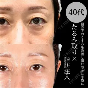 症例
