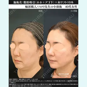 湘南美容クリニック 川崎院 伊藤 賀敏医師の症例