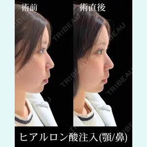 HAAB×DREAM BEAUTY CLINIC 東京本院 佐野 圭医師の症例