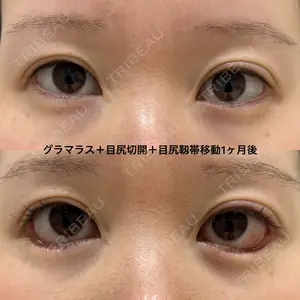 エターナル美容クリニックの症例