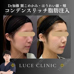 ルーチェクリニック 銀座院 加藤晴之輔医師の症例
