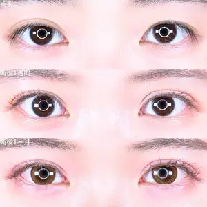 症例