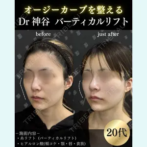 EMMO FACE CLINIC 大阪梅田院 神谷 一成医師の症例