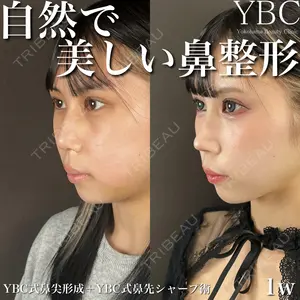 YBC横浜美容外科 立川院の症例