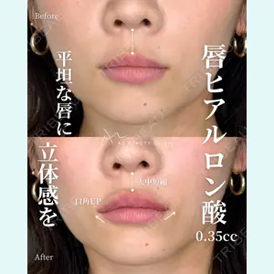 AZ BEAUTY CLINIC 木村 潤医師の症例
