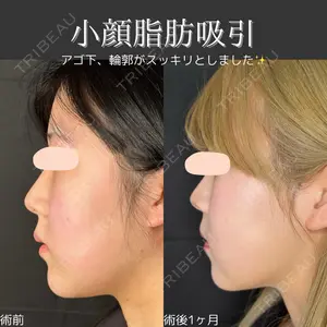 ルラ美容クリニック 仙台院 橋本 英樹医師の症例