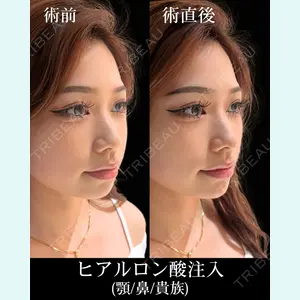 HAAB×DREAM BEAUTY CLINIC 東京本院 佐野 圭医師の症例