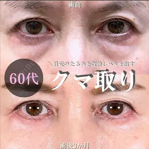 症例
