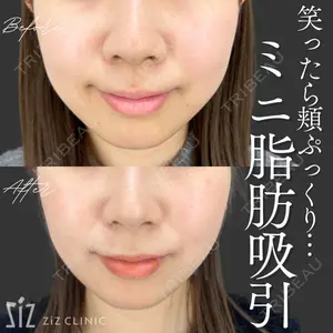 ziz CLINIC 村岡 史子医師の症例