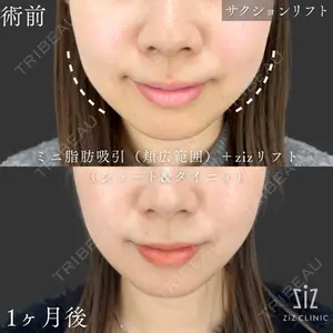 ziz CLINIC 村岡 史子医師の症例