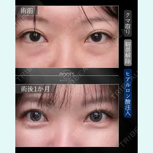 症例