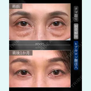 症例