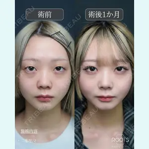 症例