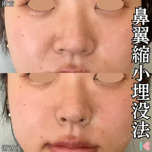 症例
