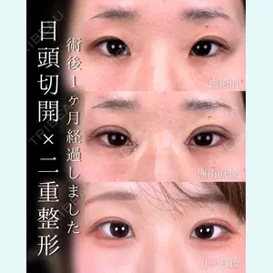 症例