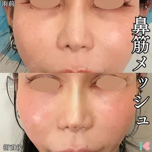 症例