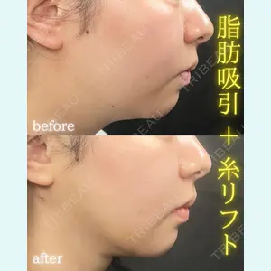 THE FIRST CLINIC 町田院 木暮 啓一郎医師の症例