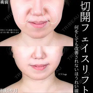 アリエル美容クリニック 大宮院 阪野 一世医師の症例
