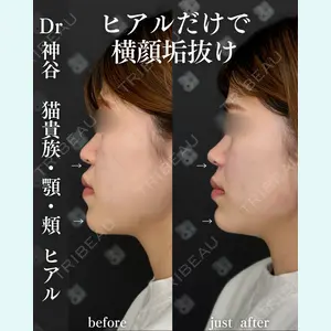 EMMO FACE CLINIC 大阪梅田院 神谷 一成医師の症例