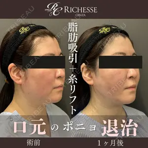 銀座リシェスクリニック 平岡 美樹子医師の症例