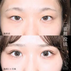 藤・ナチュレ美容クリニック 銀座院 小川 杏平医師の症例