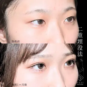 藤・ナチュレ美容クリニック 銀座院 小川 杏平医師の症例