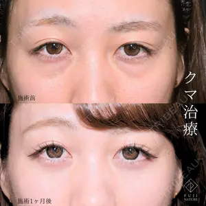 藤・ナチュレ美容クリニック 銀座院 小川 杏平医師の症例