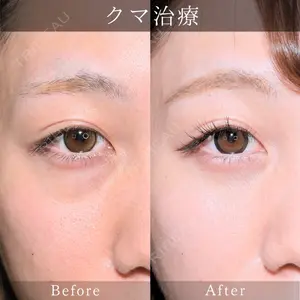 藤・ナチュレ美容クリニック 銀座院 小川 杏平医師の症例