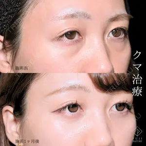 藤・ナチュレ美容クリニック 銀座院 小川 杏平医師の症例