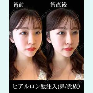 HAAB×DREAM BEAUTY CLINIC 東京本院 佐野 圭医師の症例