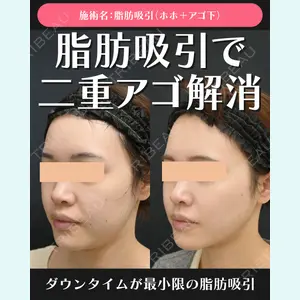 湘南美容クリニック 川崎院 伊藤 賀敏医師の症例